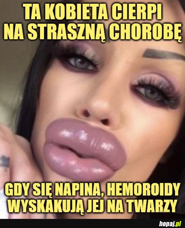 Straszna choroba!