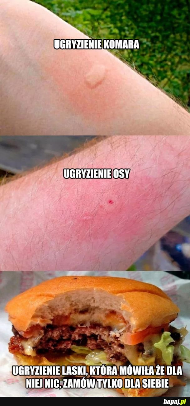 Rodzaje ugryzienia