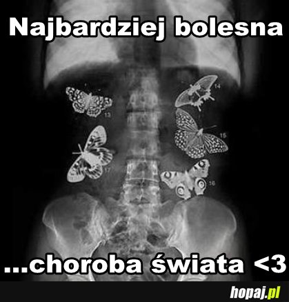 Najbardziej bolesna choroba świata