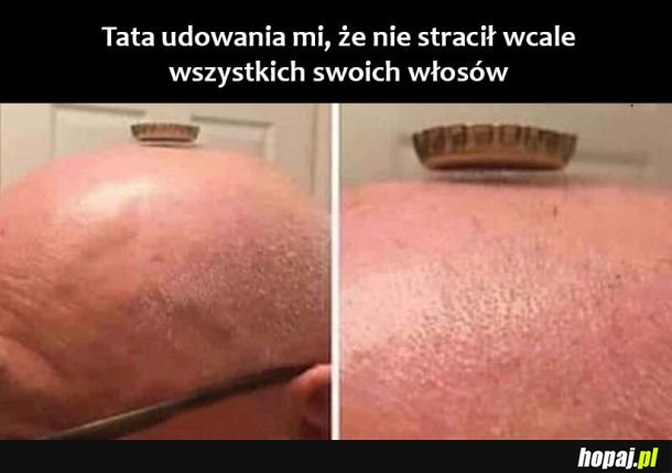 Łysinka taty 