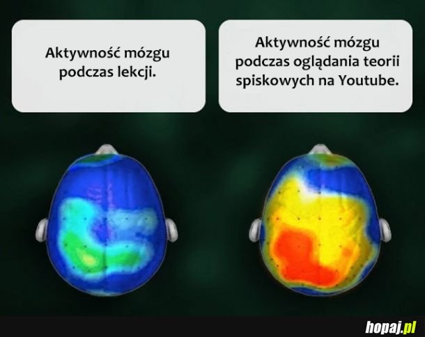 Aktywność mózgu