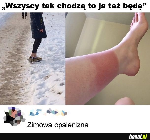 Zimowa opalenizna