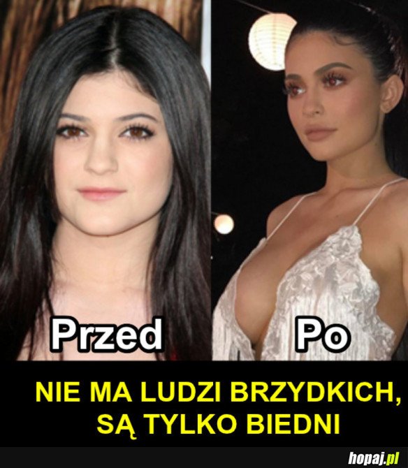 KYLIE JENNER PRZED I PO (UDANYCH?) OPERACJACH PLASTYCZNYCH