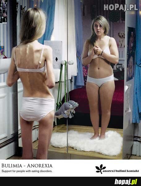Tak działa bulimia - anorexia
