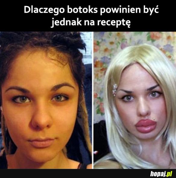 Właśnie dlatego