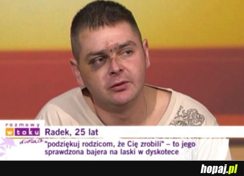Radek, 25 lat