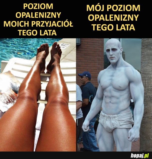 Opalenizna