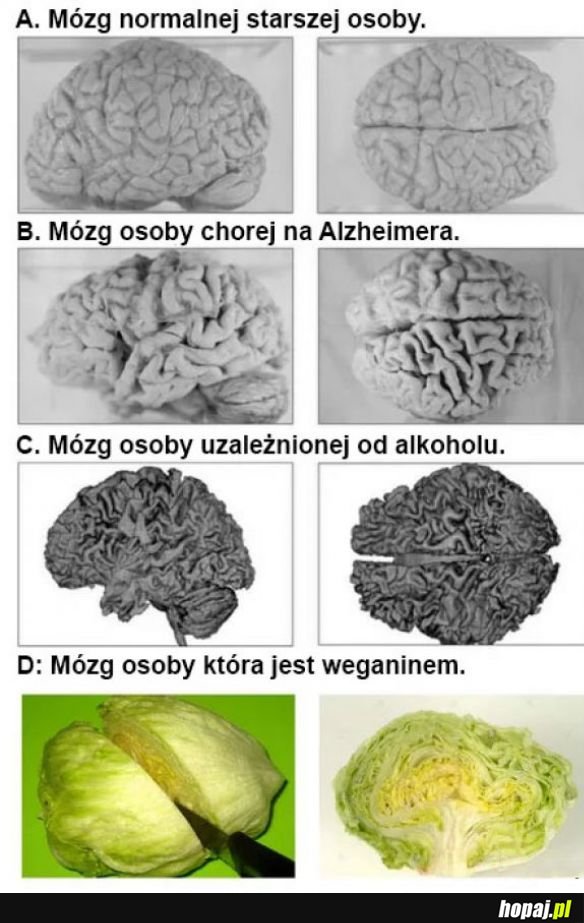 Mózgi
