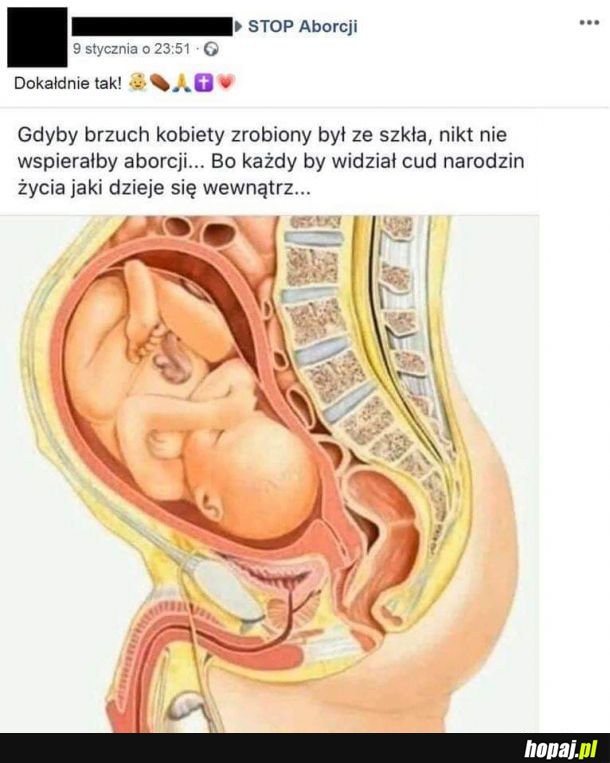 Ale, że czym to dziecko wyjdzie na świat???