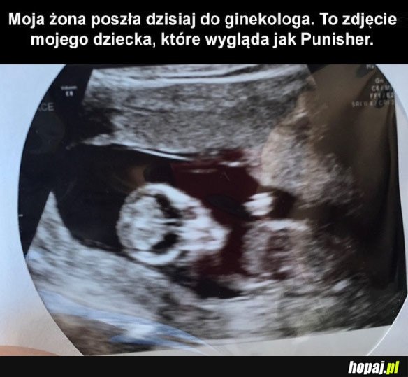 TO MOJE DZIECKO?