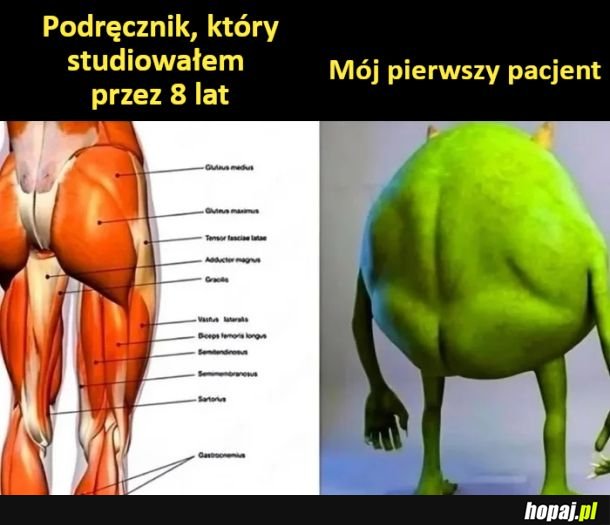 Nie pokrywa się xd