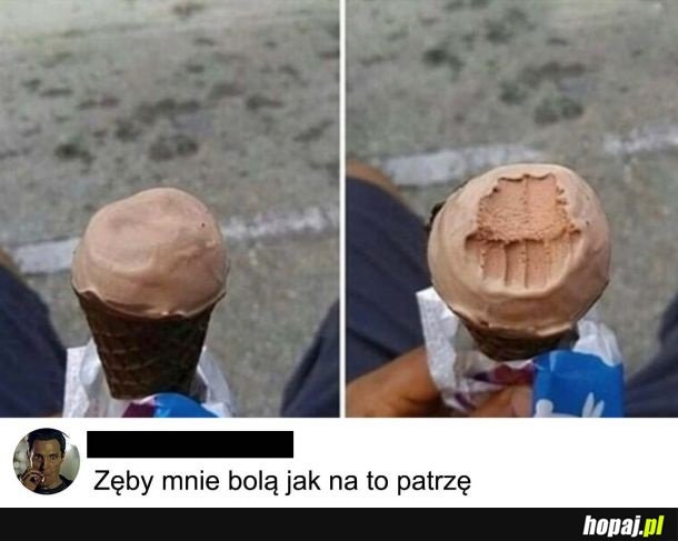 Nadwrażliwość zębów