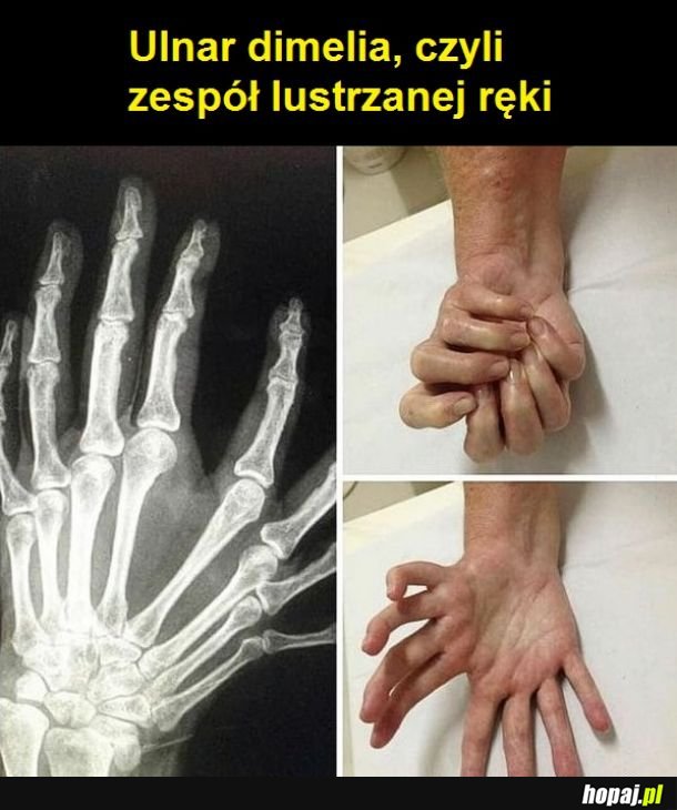 Taka tam rączka