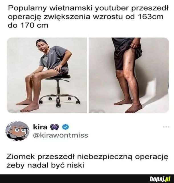 W dodatku teraz ma nieproporcjonalnie długie nogi w porównaniu do tułowia