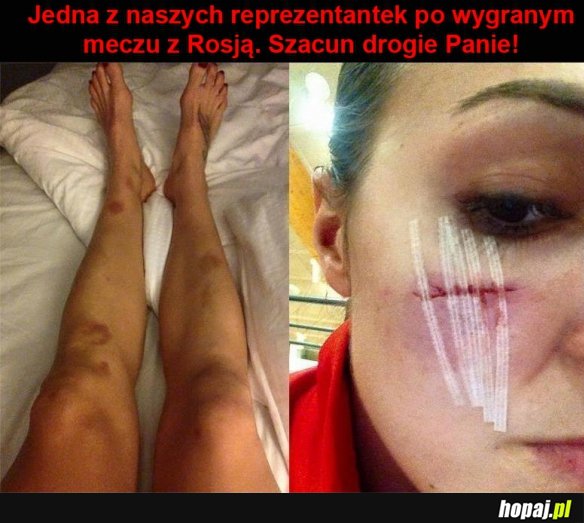 Brawo za walkę