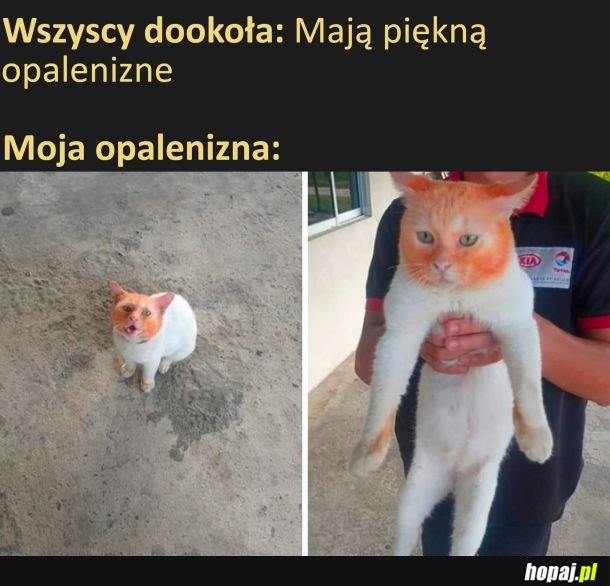Opalenizna