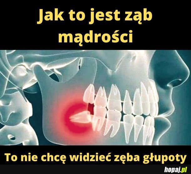 Ząb głupoty.