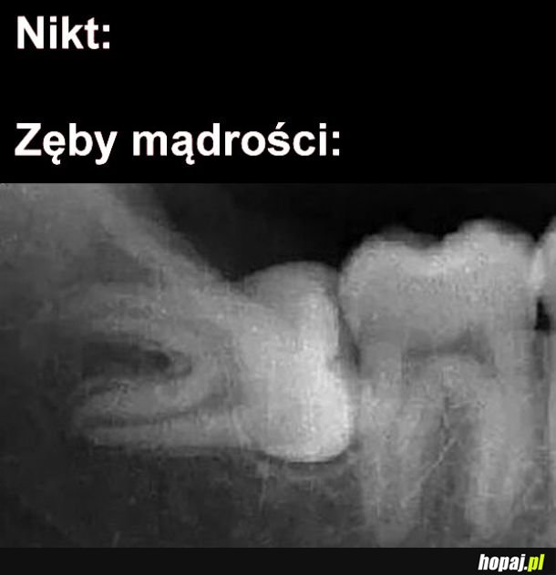 Zęby mądrości