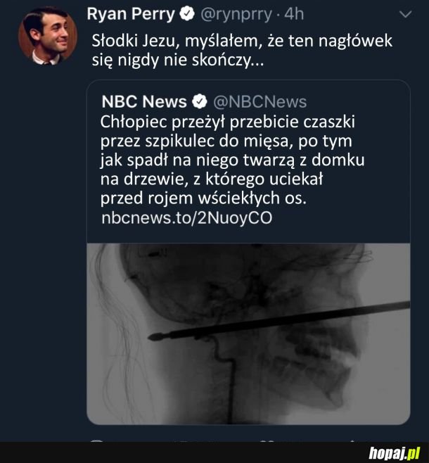 Chłopiec miał prawdziwy niefart