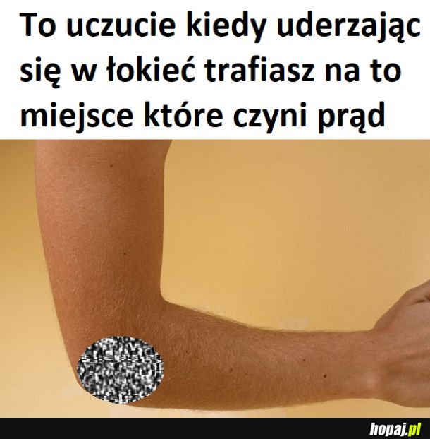 Uderzenie się w łokieć