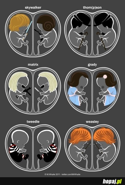 Brains