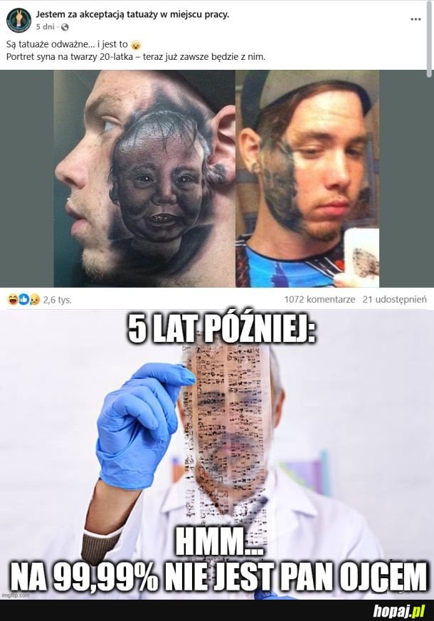 Bardzo boli usuwanie