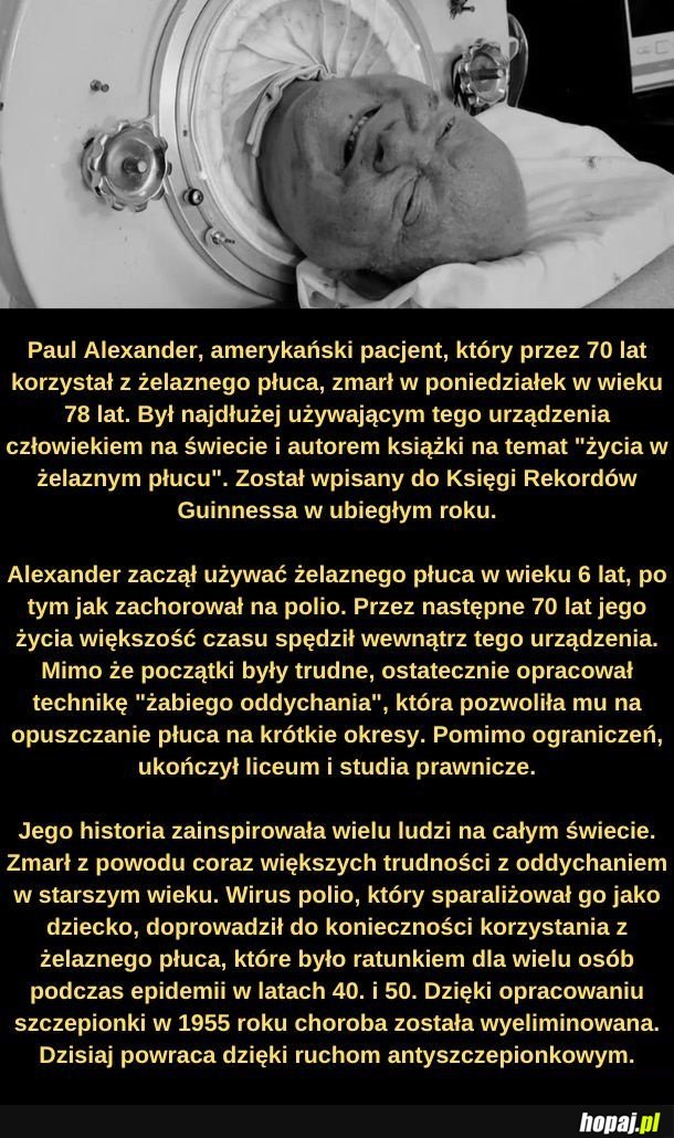 Zmarł człowiek z żelaznego płuca.