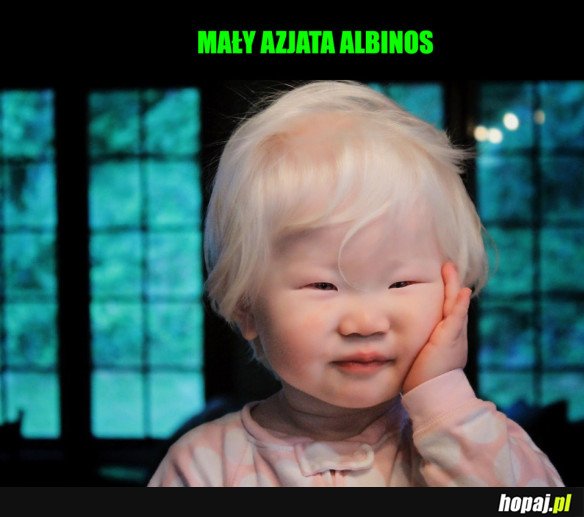 ALBINOS