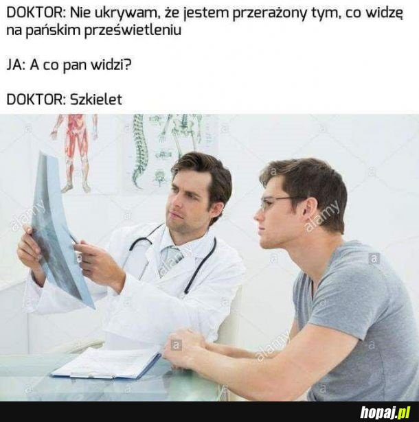 Problem na prześwietleniu