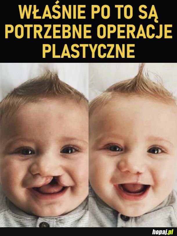 Operacje plastyczne