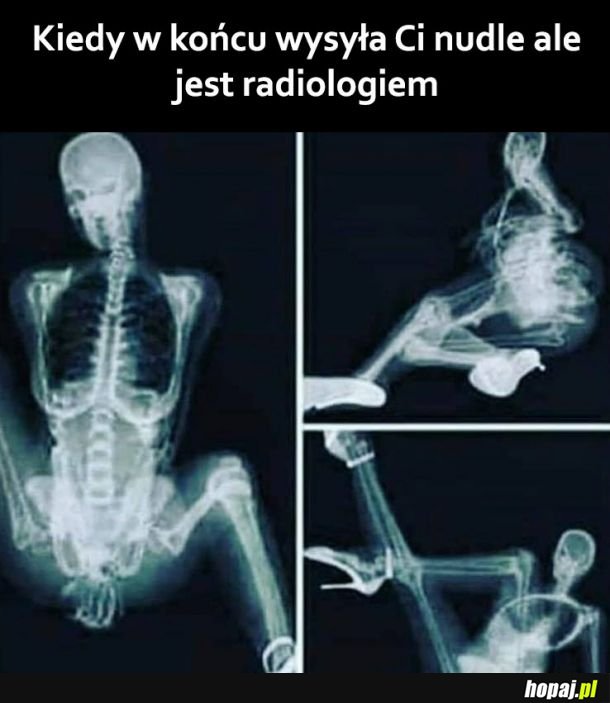 Niegrzeczna radiolożka