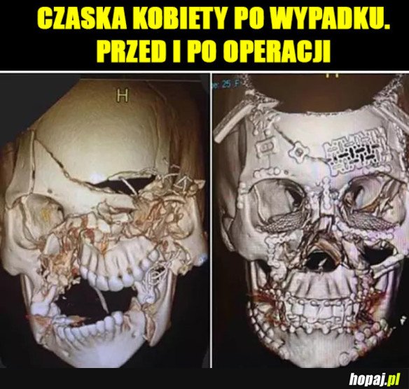 WSPÓŁCZESNA MEDYCYNA POTRAFI ZDZIAŁAĆ CUDA
